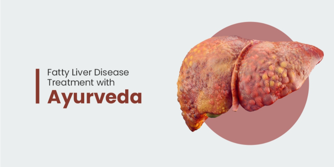 Ayurvedic Treatment for Fatty Liver